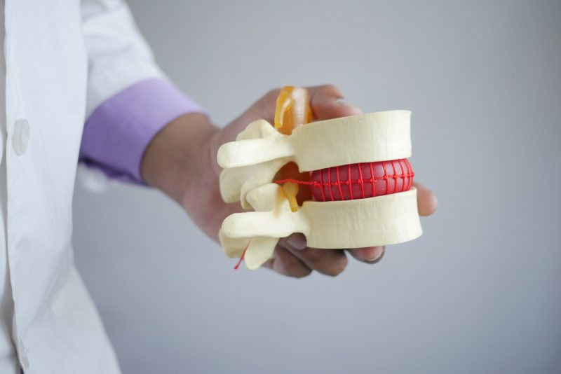Hernia discal