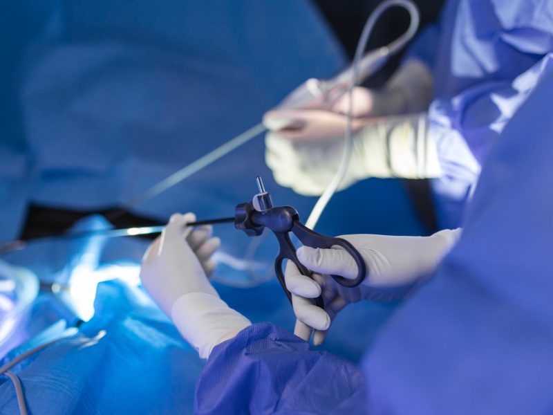 cirujano-perfora-instrumento-abdomen-paciente-cirujano-realiza-cirugia-laparoscopica-quirofano-cirugia-minimamente-invasiva.jpg